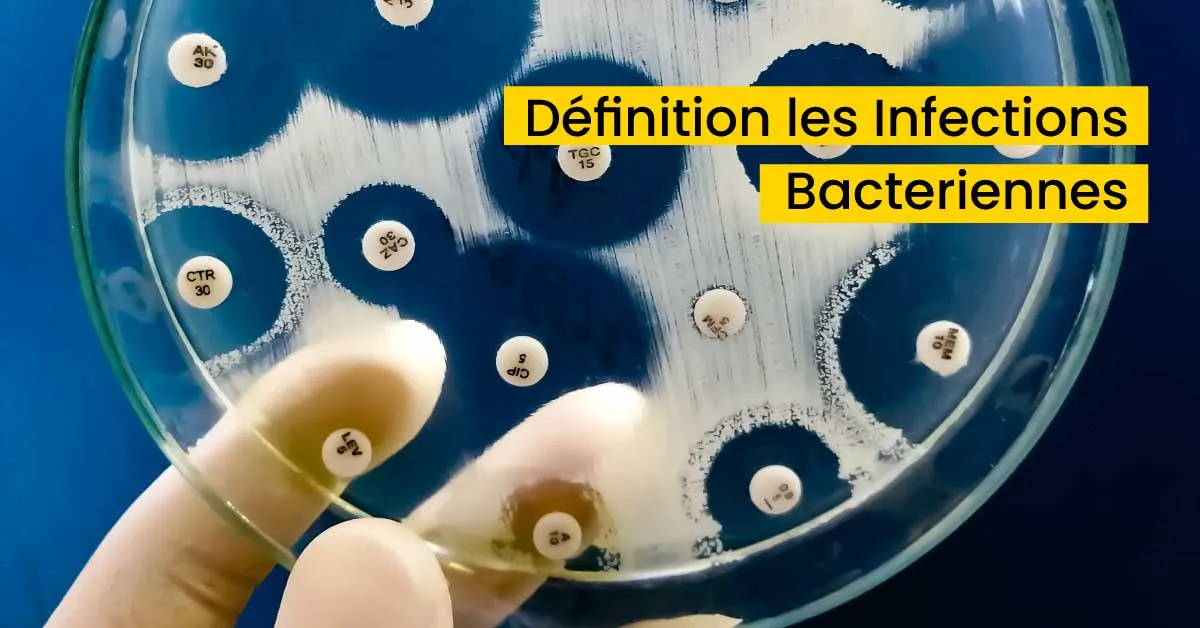 Définition  les Infections Bacteriennes